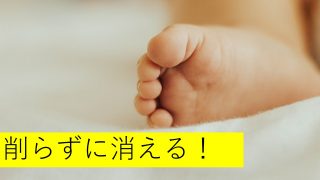 外反母趾を治す 外反母趾改善のための情報サイト 外反母趾を治す 外反母趾改善のための情報サイト